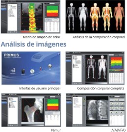 DENSITOMETRO DE CUERPO COMPLETO OSTEOSYS PRIMUS - Image 5