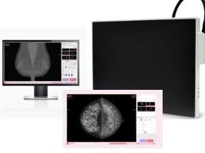 FLAT PANEL PARA MAMOGRAFIA VIEWORKS VIVIX-M 2430S