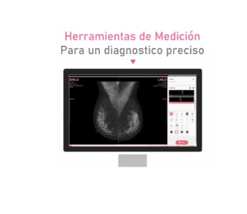 FLAT PANEL PARA MAMOGRAFIA VIEWORKS VIVIX-M 2430S - Image 4